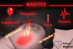 Lire la suite à propos de l’article Soigner la mastite pendant l’allaitement