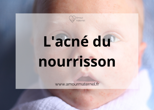 Lire la suite à propos de l’article Acné du nourrisson : quoi faire ?