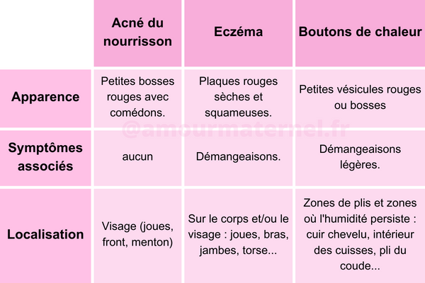 acné nourrisson tableau comparatif avec eczéma et boutons de chaleur